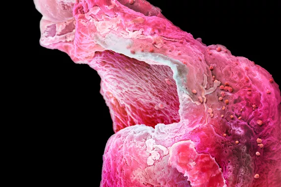 High resolution picture of an artificial heart muscle from a research lab in Cambridge. High resolution picture of an artificial heart muscle from a research lab in Cambridge.