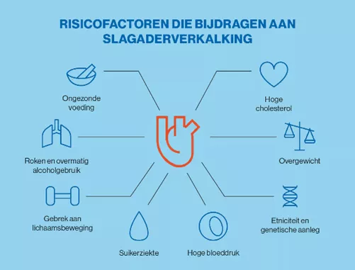 infographic risicos slagaderverkalking