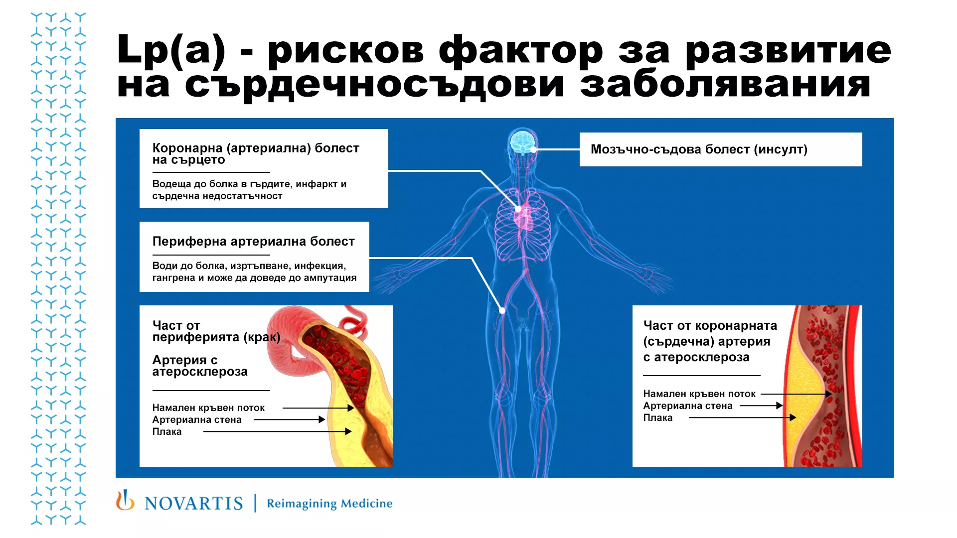 Lp (a) като рисков фактор