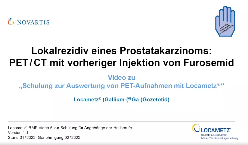 Video 5 Klinische Fallbeispiele - Lokalrezidiv eines Prostatakarzinoms: PET/CT mit vorheriger Injektion von Furosemid